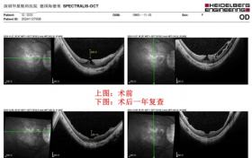 香港患者在深圳华厦：很幸运找到您
